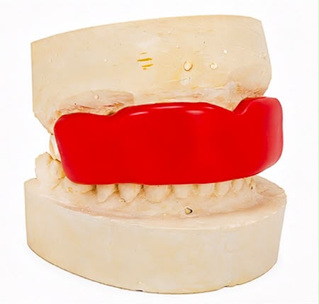Prótesis dental DENTIMOL
